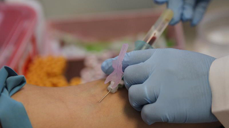 prueba-VIH
