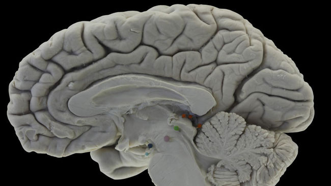 tlmd_cerebro_humano