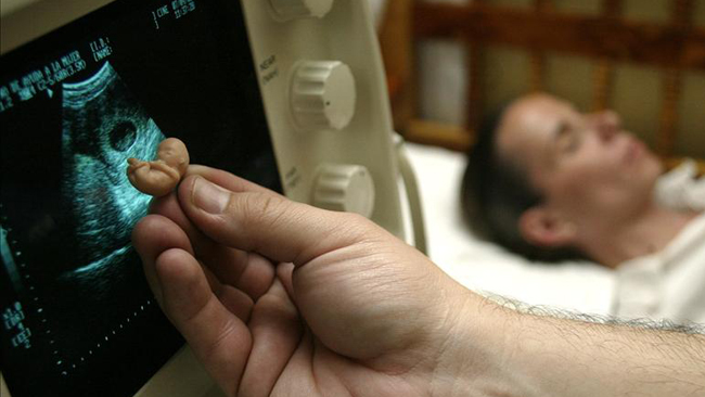 tlmd_disminuye_acceso_al_aborto