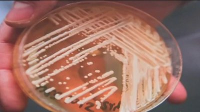 Preocupación en Nevada por la superbacteria Candida Auris