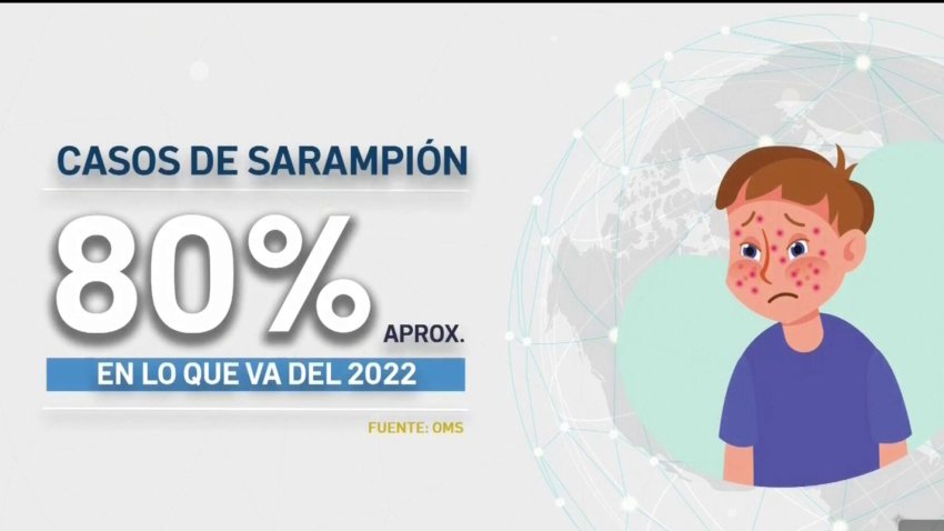 Expertos advierten de brote de sarampión en niños ¿cómo prevenirlo?