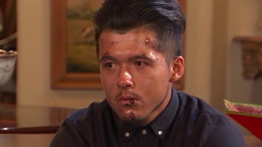“No fue a propósito”: habla conductor involucrado en atropellamiento de 25 reclutas