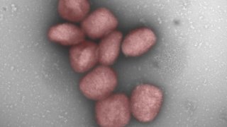 partículas del virus de la viruela del mono