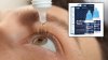 No las uses: los CDC advierten sobre mortal infección relacionada a gotas para los ojos