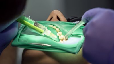 Horror en el sótano: paciente de falso dentista termina con un balazo en la cabeza