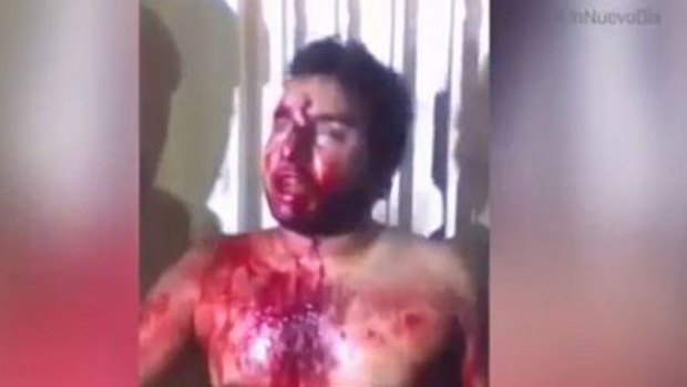 Video: Venezuela: estremece joven apaleado