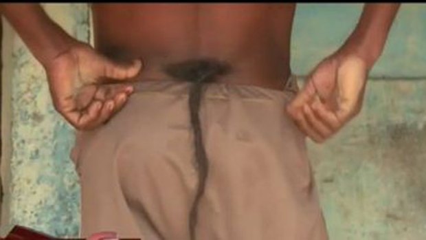 Video: Joven con cola revoluciona la India